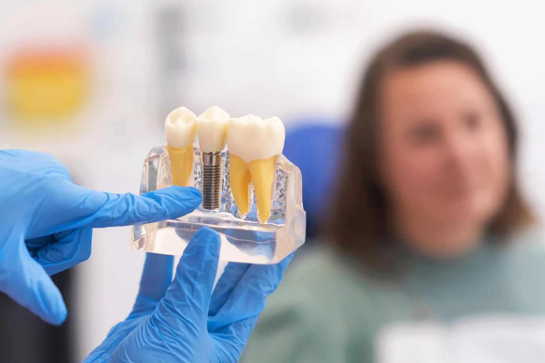 A dentist demonstrating an implant-supported tooth during an implant restoration consultation